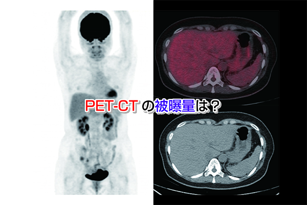 【画像あり】PET-CT検査の被曝量は？毎年受けても大丈夫？