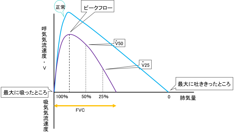 Flow-volume curve 1