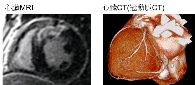 heart doc coronary CT and heart MRI