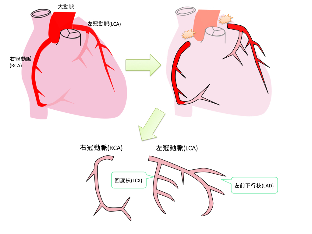 coronal-artery-001