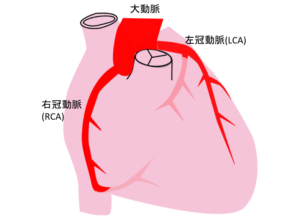 coronal-artery-002