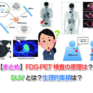 糖尿病の検査方法と数値とは？どうやって発見される？