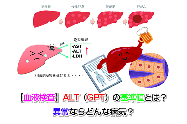【血液検査】ALT（GPT）の基準値とは？異常ならどんな病気？