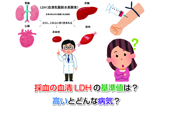 血清LDHの基準値は？高いとどんな病気？