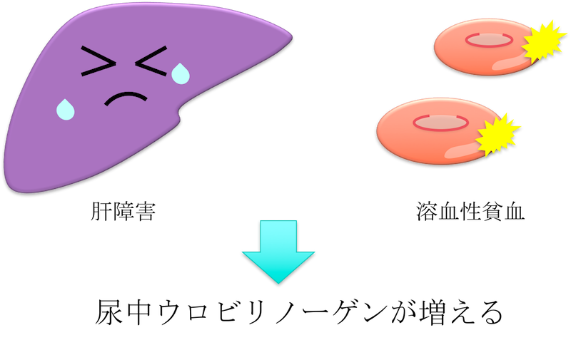 urinary urobilinogen1
