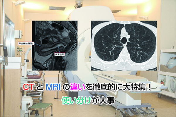 MRI and CT Eye-catching image2