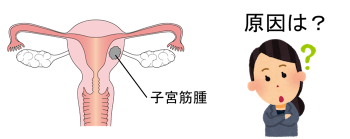 cause of uterus myoma
