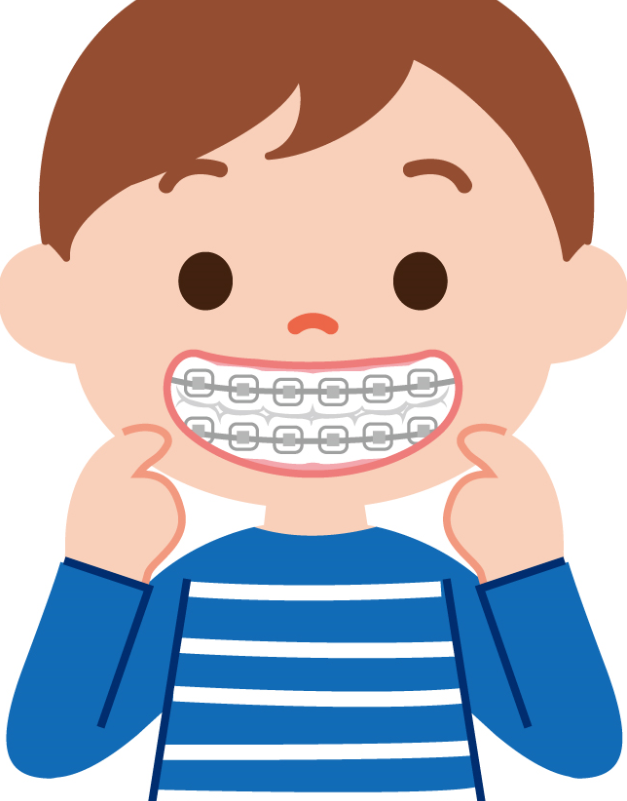 歯並びが悪いと矯正が必要？大人と子供では治療期間が違う？