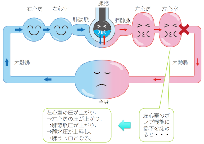 肺水腫の原因、症状から診断までまとめ