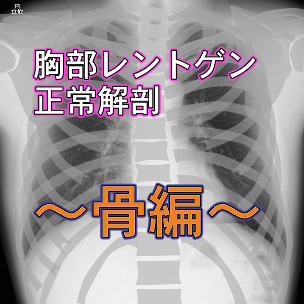 胸部レントゲンの正常解剖の読み方をわかりやすく!〜骨編〜