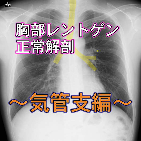胸部レントゲン写真の読み方は？〜気管・気管支編〜