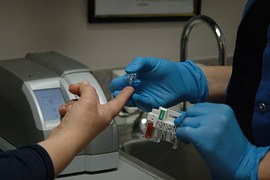 人間ドックの血液検査でHIVの感染もわかる？