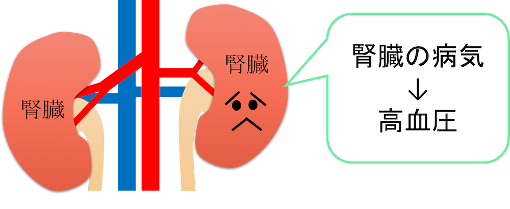 renal parenchymal hypertension figure
