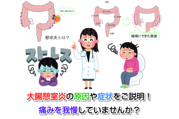 大腸憩室炎の原因や症状をご説明！痛みを我慢していませんか？