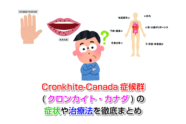 Cronkhite-Canada症候群(クロンカイト・カナダ)の症状や治療法を徹底まとめ