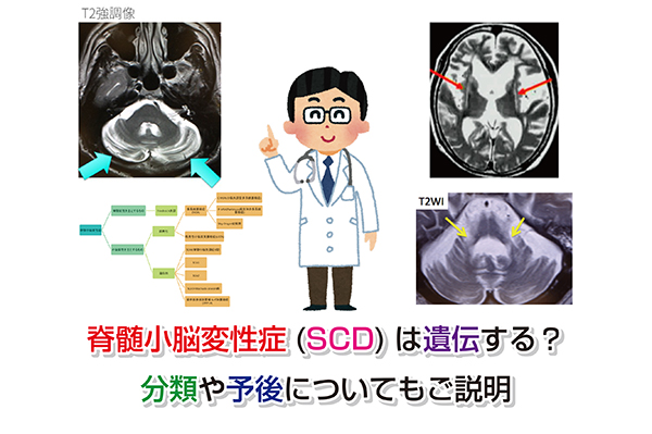 脊髄小脳変性症(SCD)は遺伝する？分類や予後についてもご説明