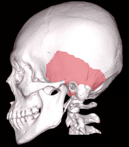 Temporal bone