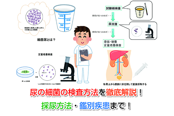 尿の細菌の検査方法を徹底解説！採尿方法・鑑別疾患まで！