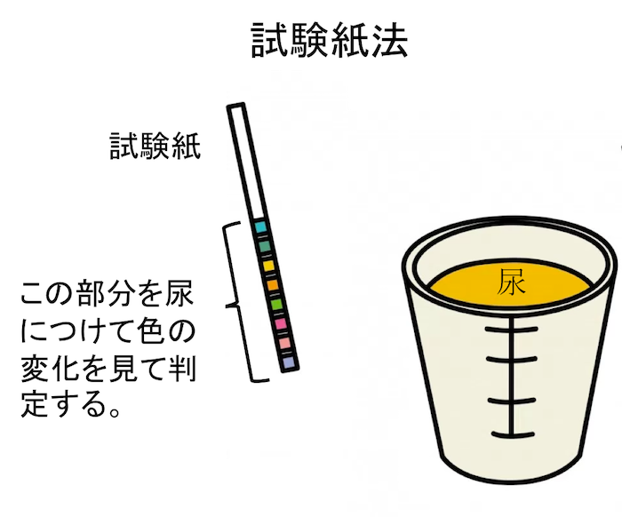 urinary test strip figure1
