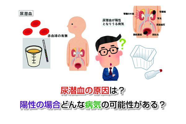 【図解】尿潜血の原因は？陽性ならどんな病気の可能性がある？