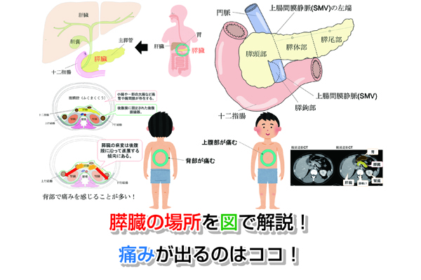 【CT画像あり】膵臓の場所を図で解説！痛みが出るのはココ！