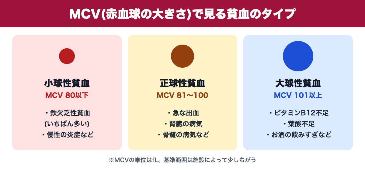 MCV(赤血球の大きさ)で見る貧血のタイプ(小球性・正球性・大球性)