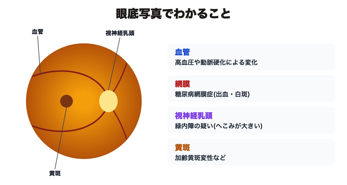 眼底写真でわかること(血管・網膜・視神経乳頭・黄斑)の模式図