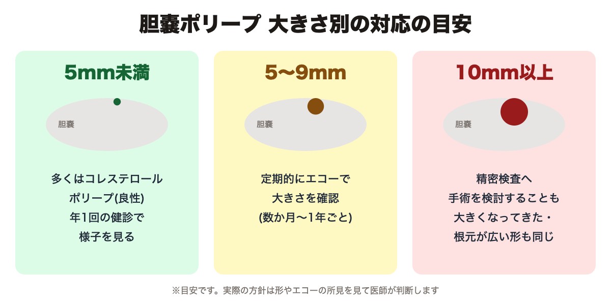 胆嚢ポリープの大きさ別の対応の目安(5mm未満・5〜9mm・10mm以上)