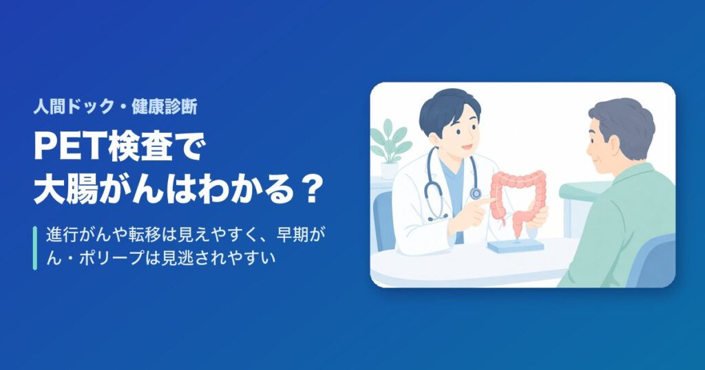 PET検査で大腸がんはわかる？進行がんや転移は見えやすく、早期がん・ポリープは見逃されやすい