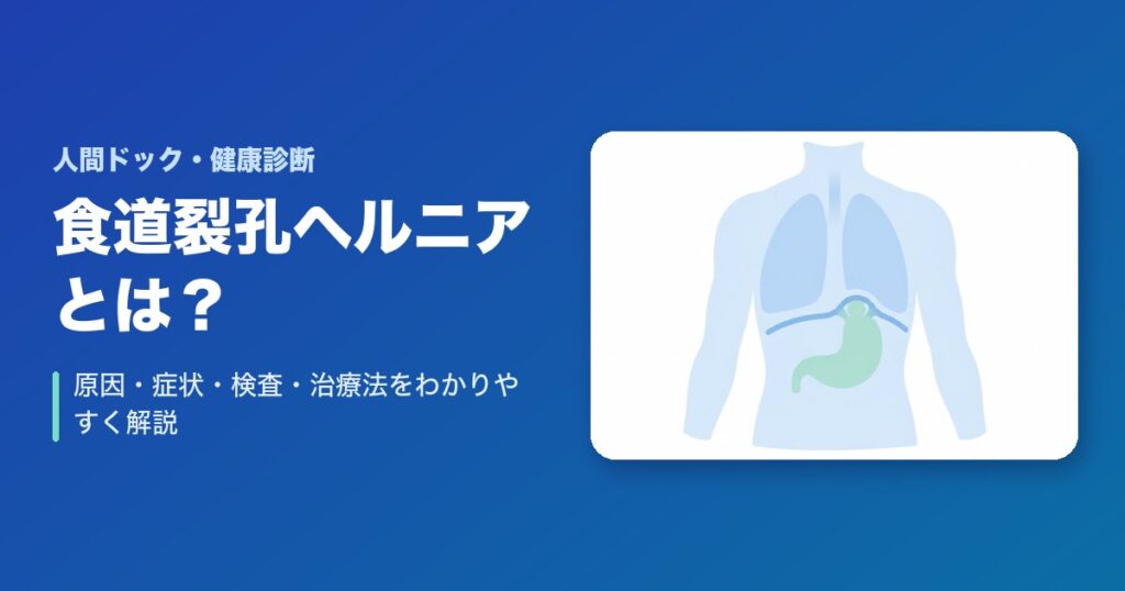 食道裂孔ヘルニアとは?原因・症状・検査・治療法をわかりやすく解説