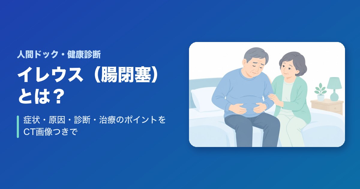 イレウス(腸閉塞)とは?症状・原因・診断・治療のポイントをCT画像つきで解説