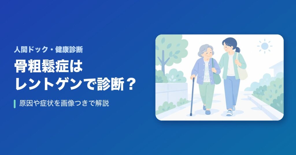 【画像あり】骨粗鬆症はレントゲンで診断できる？原因や症状は？