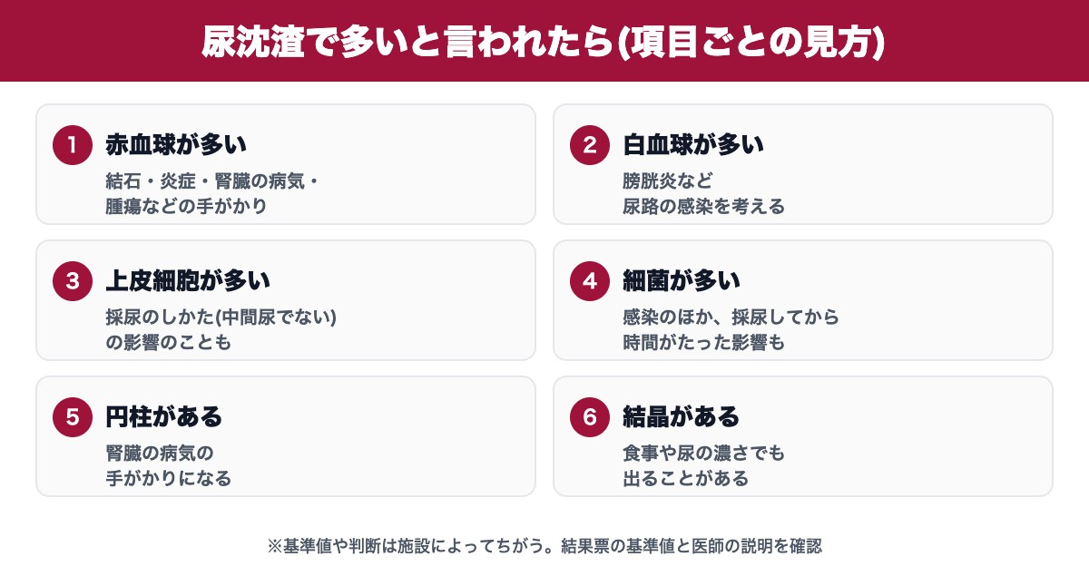 尿沈渣で多いと言われたときの項目ごとの見方(赤血球・白血球・上皮細胞・細菌・円柱・結晶)