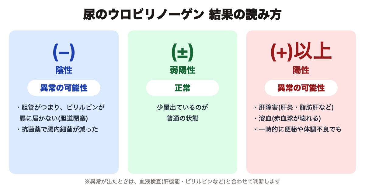 尿のウロビリノーゲンの結果の読み方((−)陰性・(±)正常・(+)陽性の主な原因)
